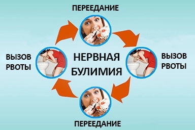 Лечение булимии в Сарапуле